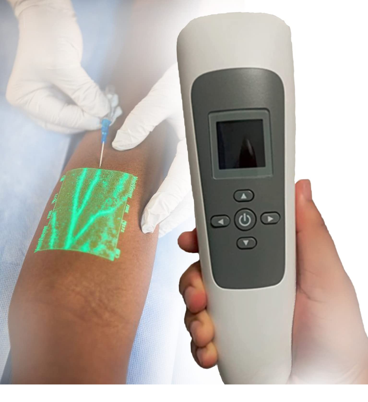 Vein Finder